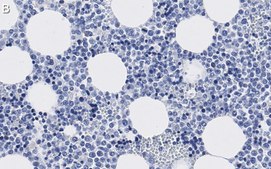 Anti-CD63 Antibody, clone 3H6 ZooMAb&#174; Rabbit Monoclonal recombinant, expressed in HEK 293 cells