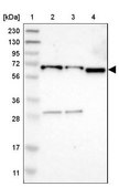 抗EIF2AK1抗体 ウサギ宿主抗体 Prestige Antibodies&#174; Powered by Atlas Antibodies, affinity isolated antibody, buffered aqueous glycerol solution