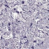 Anti-TSPYL5 antibody produced in rabbit Prestige Antibodies&#174; Powered by Atlas Antibodies, affinity isolated antibody, buffered aqueous glycerol solution