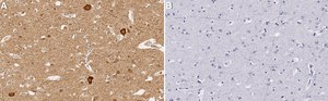 Anti-IFNAR2 Antibody, clone 1M16 ZooMAb&#174; Rabbit Monoclonal recombinant, expressed in HEK 293 cells