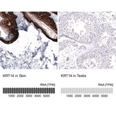 Monoclonal Anti-Krt14 Antibody Produced In Mouse Prestige Antibodies&#174; Powered by Atlas Antibodies, clone CL14565, affinity isolated antibody, buffered aqueous glycerol solution