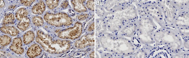 Anti-USP30 Antibody, clone 2M2-H1 ZooMAb&#174; Rabbit Monoclonal recombinant, expressed in HEK 293 cells