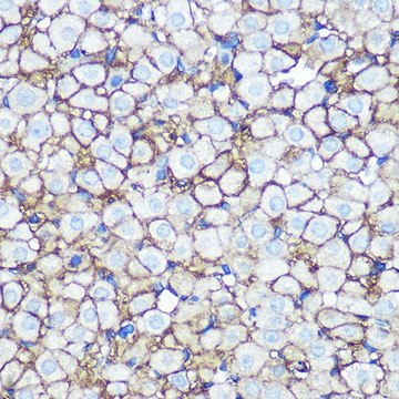 Anti-Annexin A2 antibody produced in rabbit