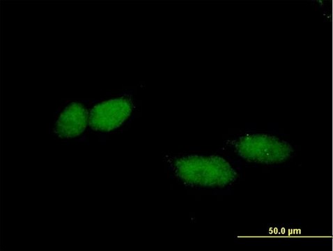 Anti-TBL1X antibody produced in mouse purified immunoglobulin, buffered aqueous solution