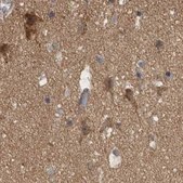 Anti-TSPOAP1 antibody produced in rabbit Prestige Antibodies&#174; Powered by Atlas Antibodies, affinity isolated antibody, buffered aqueous glycerol solution, Ab2
