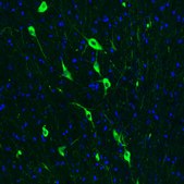 Monoclonal Anti-CHAT antibody produced in mouse Prestige Antibodies&#174; Powered by Atlas Antibodies, clone CL3173, purified immunoglobulin, buffered aqueous glycerol solution