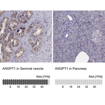 Anti-ANGPT1 antibody produced in rabbit Prestige Antibodies&#174; Powered by Atlas Antibodies, affinity isolated antibody, buffered aqueous glycerol solution, Ab1