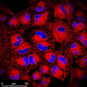 BioTracker TiY Vimentin Live Cell Dye Live cell imaging probe for identifying tumor initiating cells (TICs) in a variety of epithelial cancers, including lung cancer. The TiY probe binds to vimentin expressed in TICs.