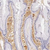 Anti-AHSG antibody produced in rabbit Prestige Antibodies&#174; Powered by Atlas Antibodies, affinity isolated antibody, buffered aqueous glycerol solution
