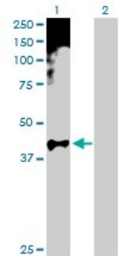Anti-HOXA11 antibody produced in rabbit purified immunoglobulin, buffered aqueous solution