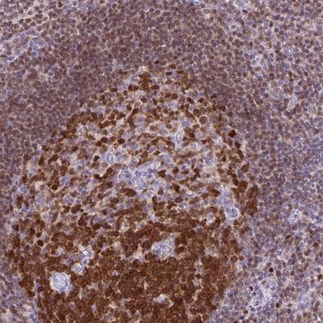 Anti-DCK antibody produced in rabbit Prestige Antibodies&#174; Powered by Atlas Antibodies, affinity isolated antibody, buffered aqueous glycerol solution