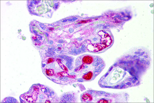 Anti-SLC26A4 antibody produced in rabbit affinity isolated antibody