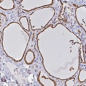 Anti-SYNCRIP antibody produced in rabbit Prestige Antibodies&#174; Powered by Atlas Antibodies, affinity isolated antibody, buffered aqueous glycerol solution