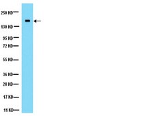 Anti-NMDAR2A Antibody Chemicon&#174;, from rabbit