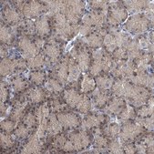 Anti-FAM83H antibody produced in rabbit Prestige Antibodies&#174; Powered by Atlas Antibodies, affinity isolated antibody, buffered aqueous glycerol solution, Ab1