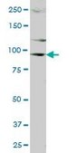 Anti-DDX20 antibody produced in mouse purified immunoglobulin, buffered aqueous solution