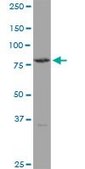 Anti-TGM4 antibody produced in mouse purified immunoglobulin, buffered aqueous solution