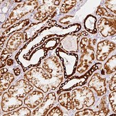 Anti-MT-CO2 antibody produced in rabbit Prestige Antibodies&#174; Powered by Atlas Antibodies, affinity isolated antibody, buffered aqueous glycerol solution