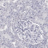 Anti-IRF4 antibody produced in rabbit Ab1, Prestige Antibodies&#174; Powered by Atlas Antibodies, affinity isolated antibody, buffered aqueous glycerol solution
