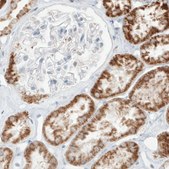 Monoclonal Anti-SDHB antibody produced in mouse Prestige Antibodies&#174; Powered by Atlas Antibodies, clone CL0346, purified immunoglobulin, buffered aqueous glycerol solution
