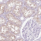 Anti-COL9A2 antibody produced in rabbit Prestige Antibodies&#174; Powered by Atlas Antibodies, affinity isolated antibody, buffered aqueous glycerol solution