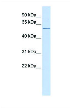 Anti-ACVR1C antibody produced in rabbit affinity isolated antibody