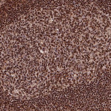 Anti-EXOSC9 antibody produced in rabbit Prestige Antibodies&#174; Powered by Atlas Antibodies, affinity isolated antibody
