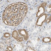 Anti-S100A6 antibody produced in rabbit Prestige Antibodies&#174; Powered by Atlas Antibodies, affinity isolated antibody, buffered aqueous glycerol solution
