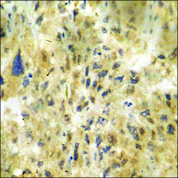 Anti-phospho-CDK5 (pTyr15) antibody produced in rabbit affinity isolated antibody