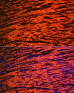 Anti-MYL2 antibody produced in rabbit