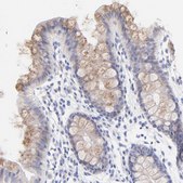 Anti-EBP antibody produced in rabbit Prestige Antibodies&#174; Powered by Atlas Antibodies, affinity isolated antibody, buffered aqueous glycerol solution