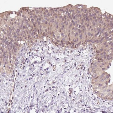 Anti-TPT1 antibody produced in rabbit Prestige Antibodies&#174; Powered by Atlas Antibodies, affinity isolated antibody, buffered aqueous glycerol solution