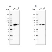 Anti-FGB antibody produced in rabbit Ab1, Prestige Antibodies&#174; Powered by Atlas Antibodies, affinity isolated antibody, buffered aqueous glycerol solution