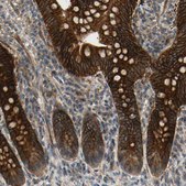 Anti-RET antibody produced in rabbit Prestige Antibodies&#174; Powered by Atlas Antibodies, affinity isolated antibody, buffered aqueous glycerol solution