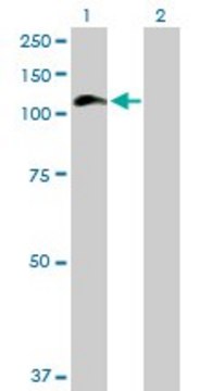 Anti-HIP1 antibody produced in mouse purified immunoglobulin, buffered aqueous solution