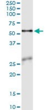 Monoclonal Anti-ASNS antibody produced in mouse clone 2B3, purified immunoglobulin, buffered aqueous solution