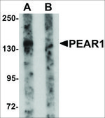 Anti-PEAR1 antibody produced in rabbit affinity isolated antibody, buffered aqueous solution