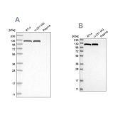 Anti-ACLY antibody produced in rabbit Prestige Antibodies&#174; Powered by Atlas Antibodies, affinity isolated antibody, buffered aqueous glycerol solution