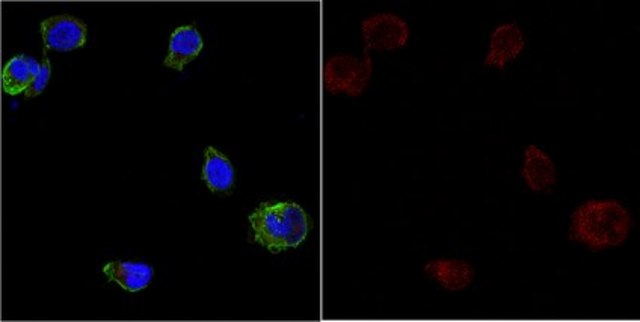 Anti-APP A4, a.a. 66-81 of APP {NT} Antibody, clone 22C11, Alexa Fluor&#8482; 647 Conjugate clone 22C11, from mouse, ALEXA FLUOR&#8482; 647