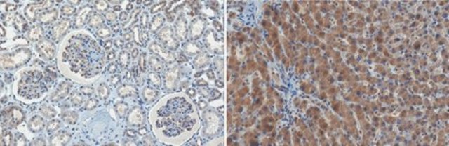 Anti-p70S6 Kinase Antibody, clone 10H11.1 clone 10H11.1, from mouse