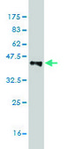 Monoclonal Anti-ASAH1 antibody produced in mouse clone 2C9, purified immunoglobulin, buffered aqueous solution