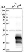 Anti-BIRC5 antibody produced in rabbit Prestige Antibodies&#174; Powered by Atlas Antibodies, affinity isolated antibody, buffered aqueous glycerol solution