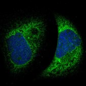 Anti-MTDH antibody produced in rabbit Ab1, Prestige Antibodies&#174; Powered by Atlas Antibodies, affinity isolated antibody, buffered aqueous glycerol solution