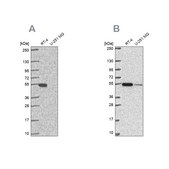 Anti-GSS antibody produced in rabbit Prestige Antibodies&#174; Powered by Atlas Antibodies, affinity isolated antibody
