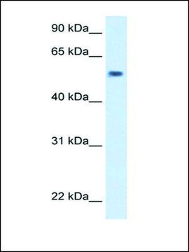 Anti-EXD antibody produced in rabbit IgG fraction of antiserum