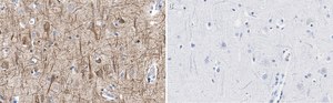 Anti-Neurofilament H Antibody, clone 2N19 ZooMAb&#174; Rabbit Monoclonal recombinant, expressed in HEK 293 cells