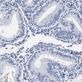 Anti-AKAP4 antibody produced in rabbit Prestige Antibodies&#174; Powered by Atlas Antibodies, affinity isolated antibody, buffered aqueous glycerol solution