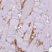 Anti-ITIH4 antibody produced in rabbit Ab2, Prestige Antibodies&#174; Powered by Atlas Antibodies, affinity isolated antibody, buffered aqueous glycerol solution