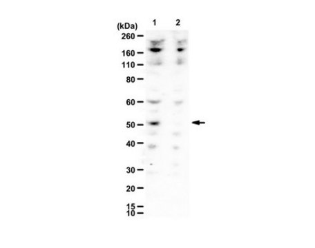 Anti-Dcp2 serum, from rabbit