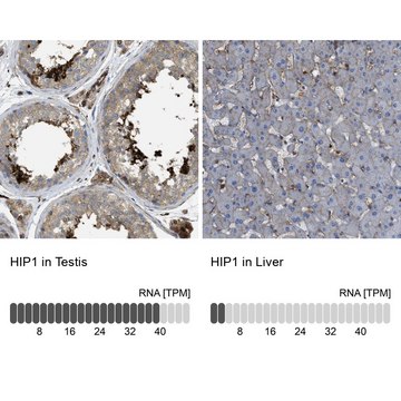 Anti-HIP1 antibody produced in rabbit Prestige Antibodies&#174; Powered by Atlas Antibodies, affinity isolated antibody, buffered aqueous glycerol solution